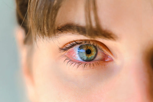 Close-up of a green eye with visible blood vessels and natural eyelashes, showing detailed iris and eyebrow area.