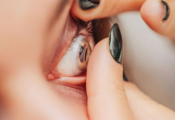 Close-up of an eye being examined with a handheld device, focusing on the iris and surrounding area.