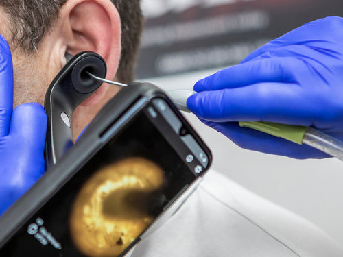 Close-up of a healthcare professional using an otoscope connected to a smartphone to examine the inside of an ear.