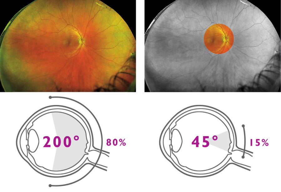 Close-up view of a stylish round cream-colored glasses frame.