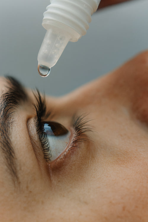 Lady having eye drops dropped into her brown eye.